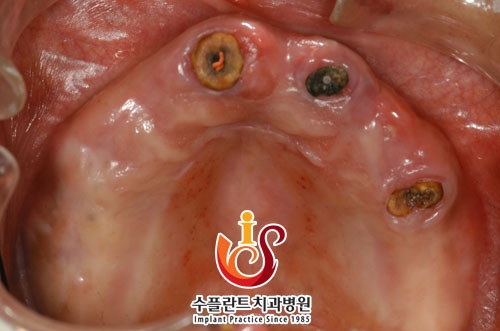 전 이미지